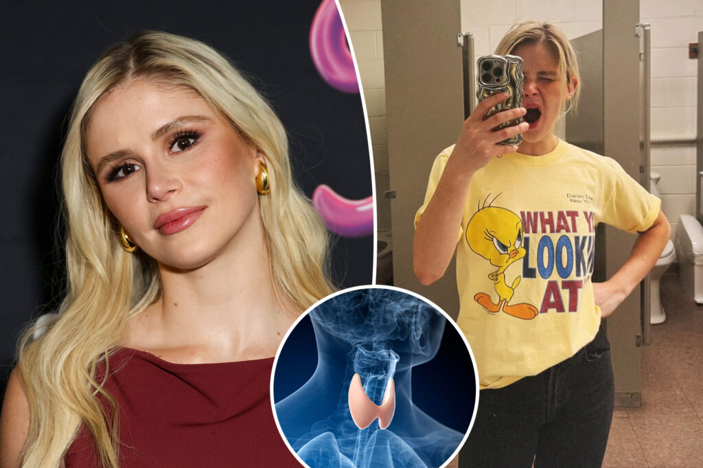 What is gravel disease? All about the diagnosis of the "boys" star Erin Moriarty